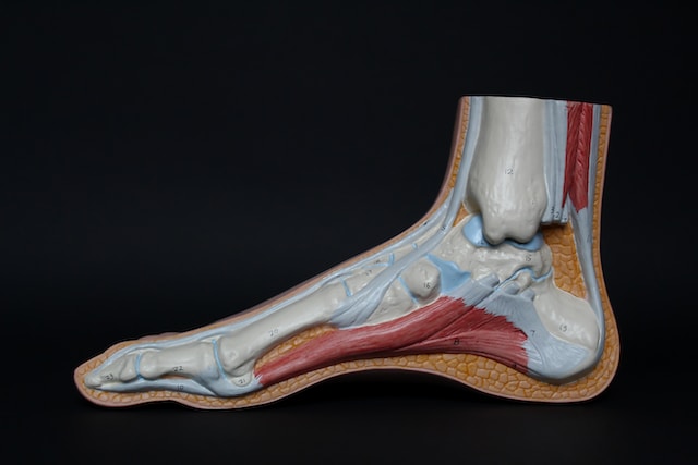 Understanding and Managing Achilles Tendinopathy: A Comprehensive Guide