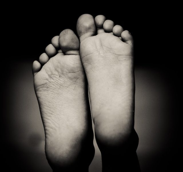 What is Plantar Fasciitis?