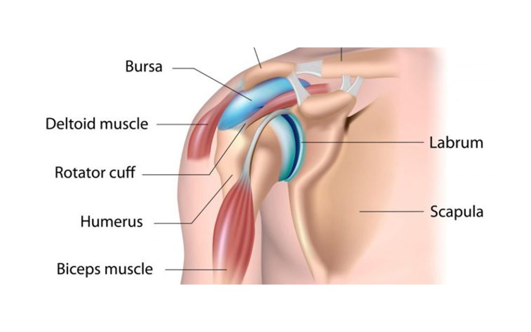 Help – I’ve got shoulder bursitis!