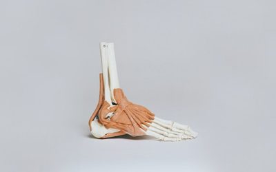 It is not ‘just’ an ankle sprain!