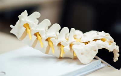 Understanding and Managing Acute Low Back Pain