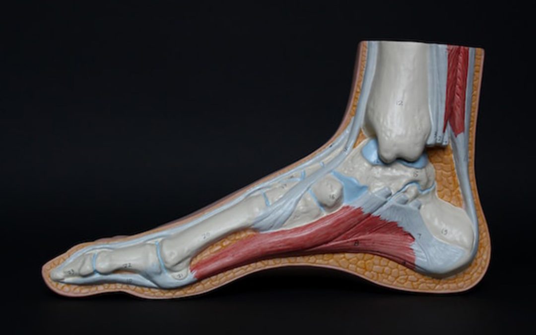 Understanding and Managing Achilles Tendinopathy: A Comprehensive Guide