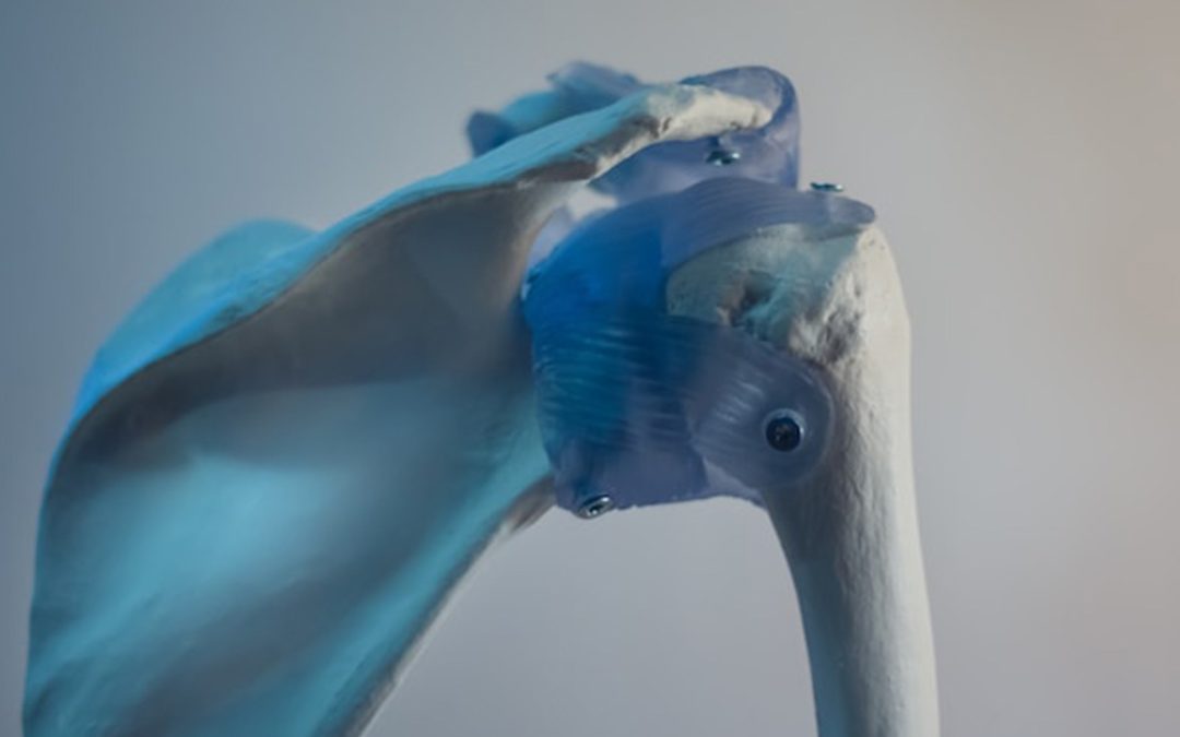 Managing a shoulder dislocation at The Physio Depot