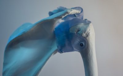 Managing a shoulder dislocation at The Physio Depot